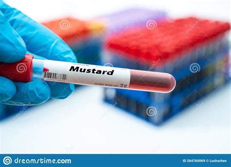 Mustard Allergy Blood Test. Test Tube in Doctor Hand Stock Image ...