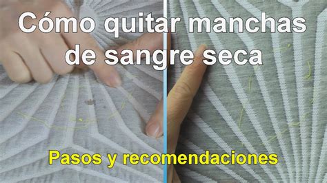 C Mo Quitar Manchas De Sangre Seca En La Ropa Youtube