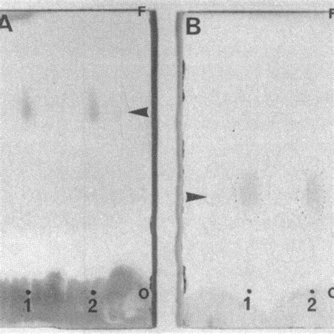 Two Dimensional Thin Layer Chromatogram Of Total Lipids From C