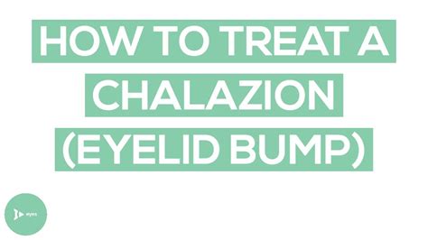 Chalazion Eyelid Bump Treatment Exactly How To Treat A Chalazion Youtube