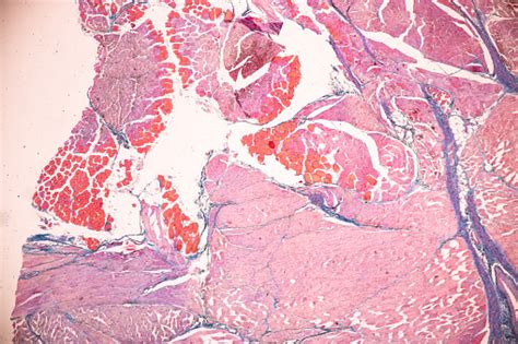 Adipose Tissue Human Soft Palate Human Bone Human And Striated Muscle