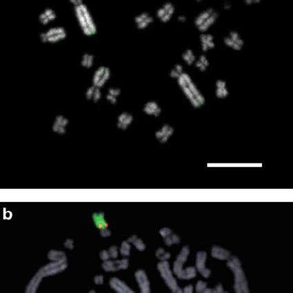PDF Sex Determination In Platypus And Echidna Autosomal Location Of SOX3 Confirms The Absence