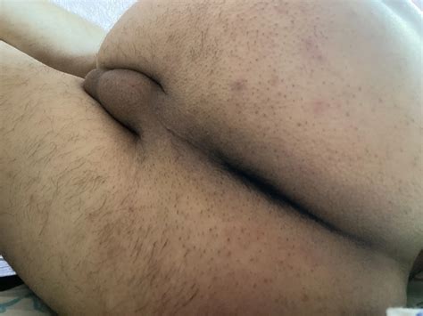 My Cock And Ass 5 Nude Pics XHamster