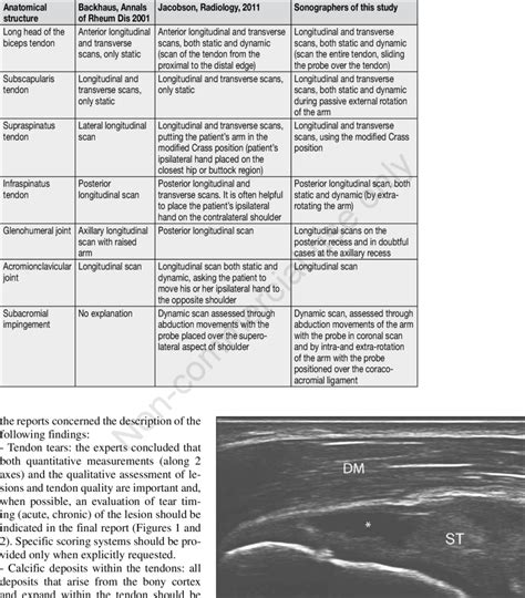 Partial Thickness Tear Of The Supraspinatus Tendon Longitudinal View