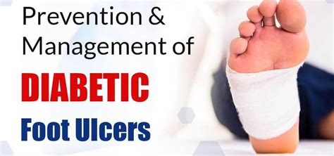 Prevention And Management Of Diabetic Foot Ulcers CuraFoot In