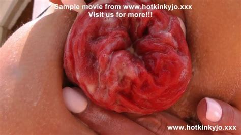 Hotkinkyjo Self Anal Fisting Prolapse Extreme At Ruined Coast Villa Xxx Mobile Porno Videos