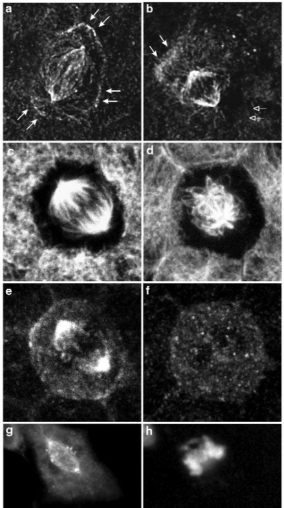 Effects Of LIS1 Overexpression On Dynactin Distribution A B