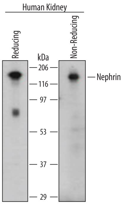Human Nephrin Antibody (AF4269) | Bio-Techne