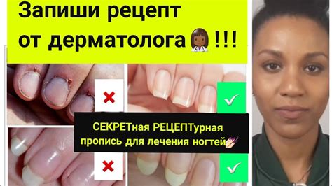 Как укрепить ногти в домашних условиях, чтобы не слоились и не ломались