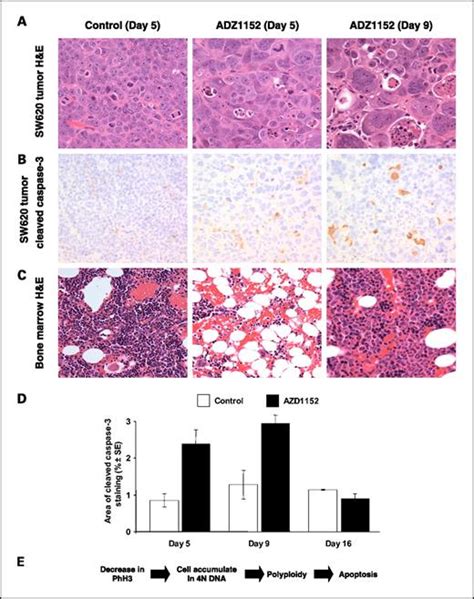 Azd1152 A Selective Inhibitor Of Aurora B Kinase Inhibits Human Tumor