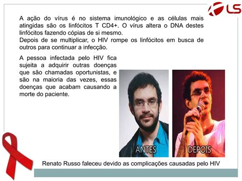 O Que é Hiv Como Se Contrai O Vírus O Que é Aids Ppt Download