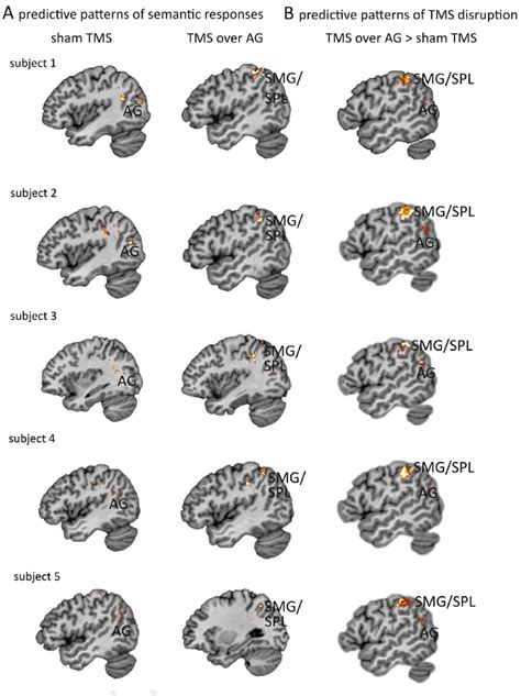 E Multi Voxel Single Subject Analysis MVPA Results From 5