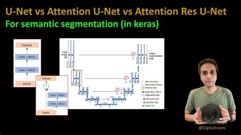 U Net Vs Attention U Net Vs Attention Residual U Net Should You Care