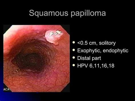 Interpretation Of Endoscopic Gastrointestinal Biopsy Ppt