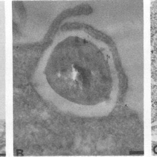 Transmission Electron Micrographs Demonstrating The Sequence Of Events