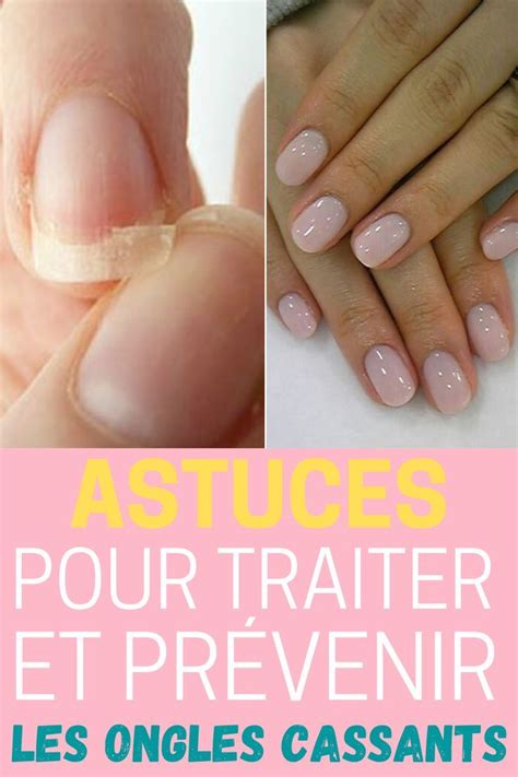 Ongles Cassants Causes Et Traitements Ongles Vernis Ongles Soin