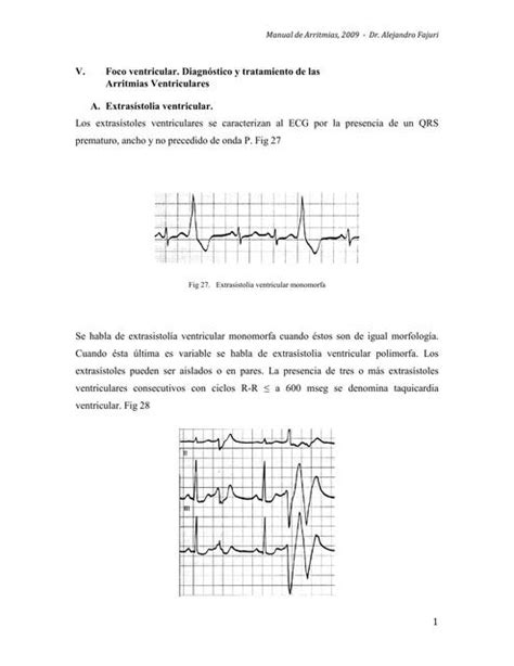 Diagn Stico Y Tratamiento De Las Arritmias Ventriculares Medicina Y