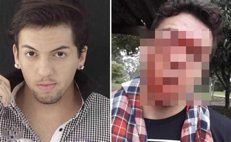 Ragazzo gay picchiato dall autista del bus sul quale viaggiava Mi ha rotto il naso perché ho