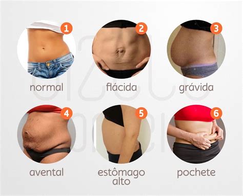 Barriga Flacida Depois Da Gravidez - Gizele Monteiro - Tudo Sobre Diástase Abdominal depois da Gravidez