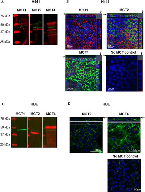 Airway Epithelia Express Monocarboxylate Transporters MCT 2 4