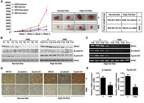 Hnk Treatment Inhibits Breast Tumor Growth In Obese State And Inhibits