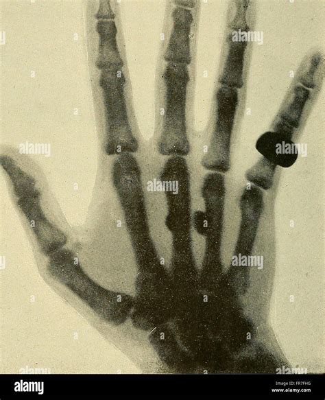 Les rayons X et la photographie a travers les corps opaques (1896 Stock ...