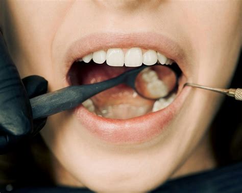 Understanding The Causes And Treatments For Receding Gums Advanced