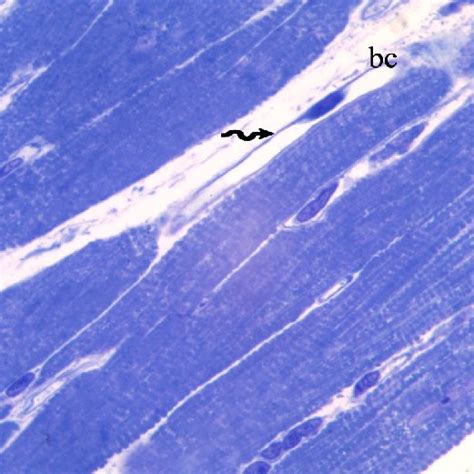 An Electron Micrograph Of A Section Of Cardiac Muscle Of The Control