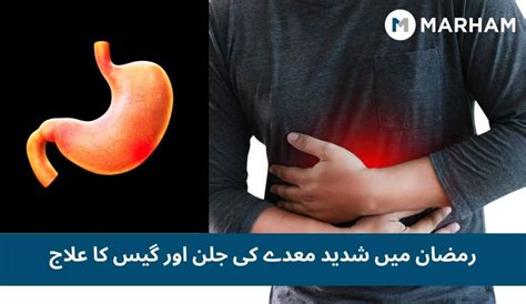 روزے کی حالت میں معدے کی جلن اور تیزابیت کی وجوہات اور اس کا علاج