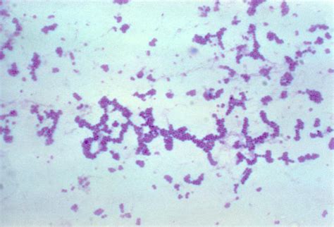 Staphylococcus Gram Stain Picture Hardin Md Cdc