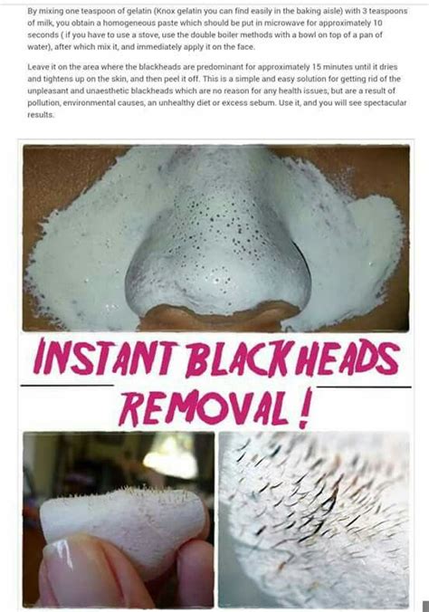 Blackhead Removal Blackhead Remover Diy Natural Skin Care Diy Skin Care