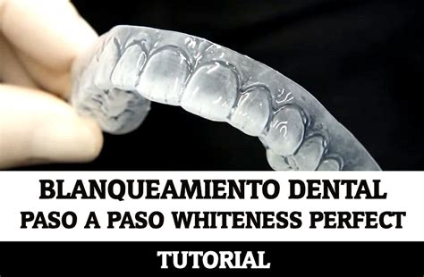 BLANQUEAMIENTO DENTAL Paso A Paso Whiteness Perfect