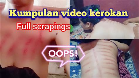 Full Scrapings Video Kumpulan Video Kerokan Wanita Scraping Youtube