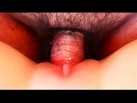 Watching A Fuck Up Close XVIDEOS