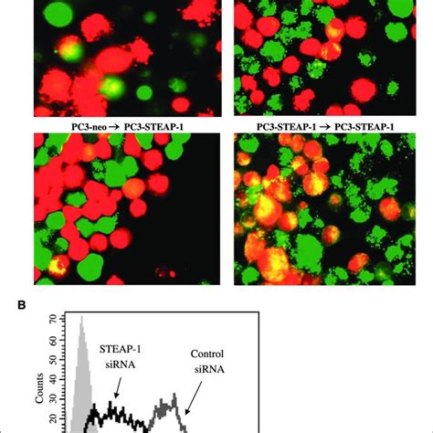 STEAP 1 Protein Expression In Prostate Bladder And Lung Cancer