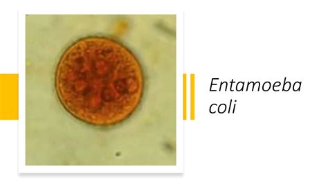 Non Pathogenic Amoeba Protozoa In The Ameba Group Inhabit Human Gastrointestinal Tract Pptx Ppt