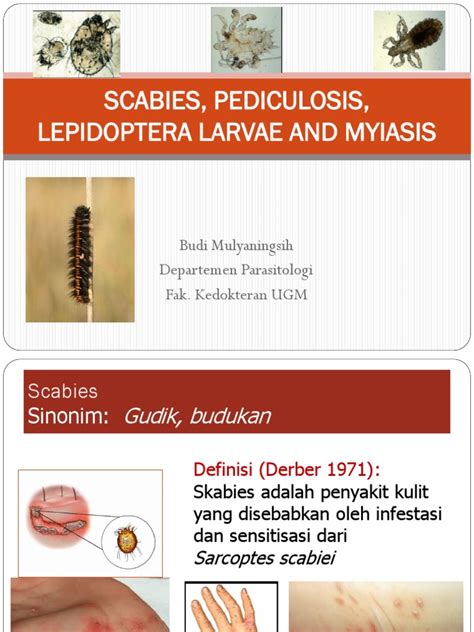 Dr Budi Mulyaningsih Scabies Pediculosis Etc Pdf