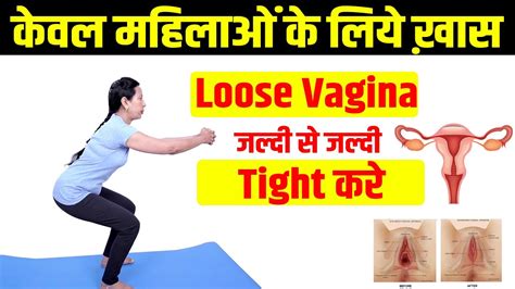 How to Tighten Loose Vagina ढल यन क टइट करन चहत ह Loose Vagina क Naturally