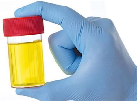 Суточный анализ мочи | отзывы