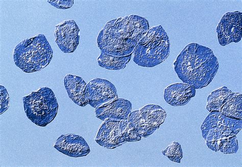 Computer-enhanced Lm Of Human Epithelial Cells Photograph by Pasieka ...