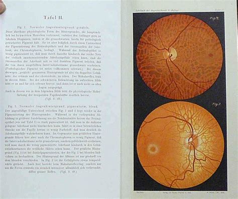 Kniha Lehrbuch Und Atlas Der Augenheilkunde Antikvari T Bene