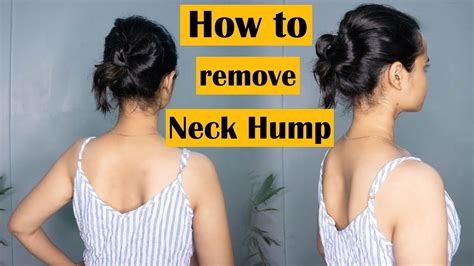 Exercises For Neck Hump How To Fix Neck Hump Fix Your Neck Hump