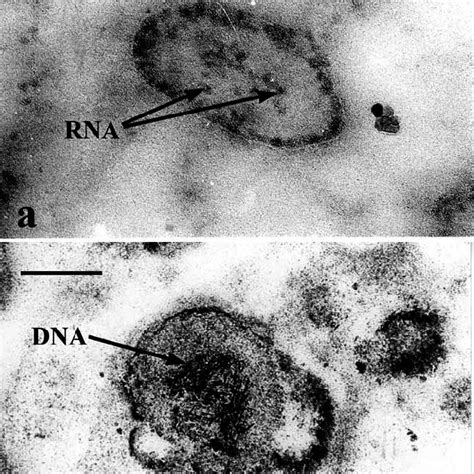 Example Of Representative Electron Micro Graphs Of RNA A And DNA B