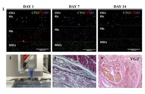 Modelo 3D Para Ver La Respuesta Del Melanoma A La Terapia