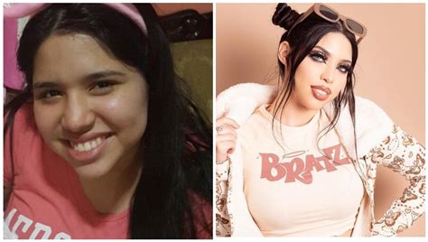 Así Lucía Yeri Mua Antes De Sus Cirugías Estéticas Gobiznext