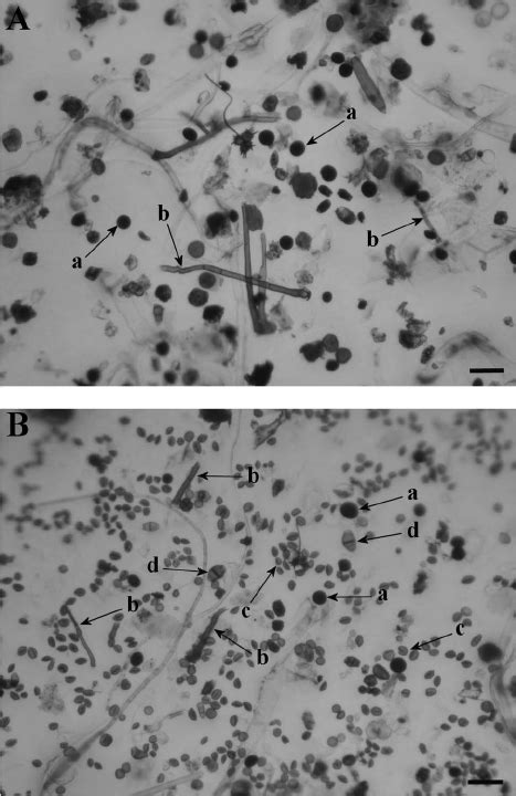Photomicrographs Of Collected Fungal Conidia And Hyphal Fragments A