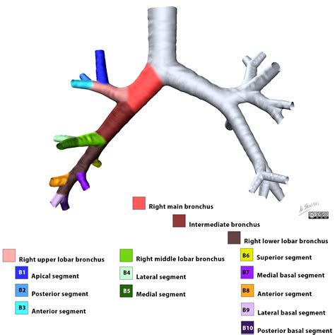 Radiopaedia Drawing Right Bronchial Tree From Anterior English