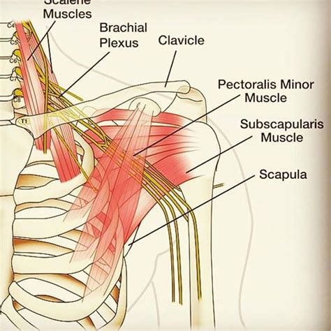 Brachial Plexus In Brachial Plexus Products Subscapularis Muscle