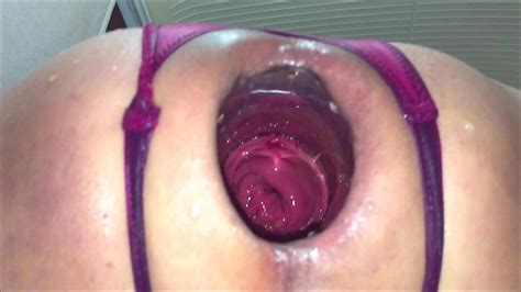 Wide Open Asspussy Jul 18 2019 Gay Gaping Amateur Porn XHamster