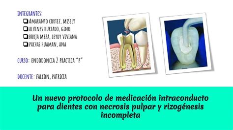 Nuevo Protocolo de Medicación Intraconducto para Dientes con Necrosis